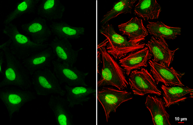 Anti-SUV39H1 antibody [N3C3] used in Immunocytochemistry/ Immunofluorescence (ICC/IF). GTX112263