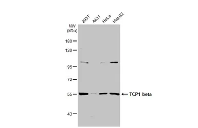 Anti-TCP1 beta antibody [C1C3] used in Western Blot (WB). GTX112283