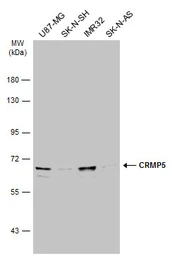 Anti-CRMP5 antibody [N1C1] used in Western Blot (WB). GTX112287