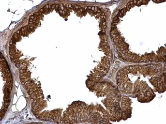 Anti-ASB2 antibody [N3C2], Internal used in IHC (Paraffin sections) (IHC-P). GTX112289