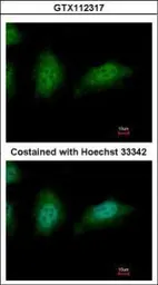 Anti-ZNHIT2 antibody used in Immunocytochemistry/ Immunofluorescence (ICC/IF). GTX112317