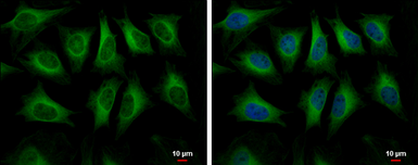 Anti-HMGCS1 antibody used in Immunocytochemistry/ Immunofluorescence (ICC/IF). GTX112346