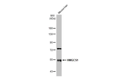 Anti-HMGCS1 antibody used in Western Blot (WB). GTX112346