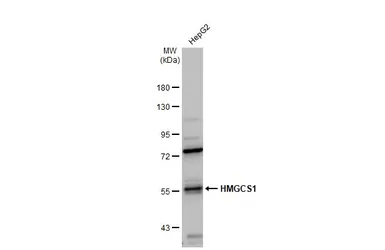 Anti-HMGCS1 antibody used in Western Blot (WB). GTX112346