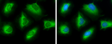 Anti-ATP citrate lyase antibody [N1N2], N-term used in Immunocytochemistry/ Immunofluorescence (ICC/IF). GTX112387
