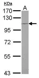 Anti-beta Adducin antibody [N3C2], Internal used in Western Blot (WB). GTX112389
