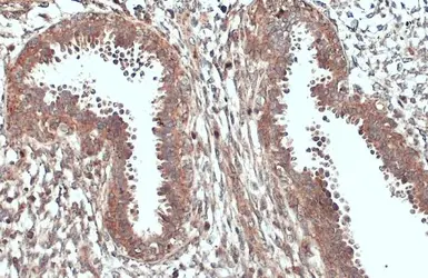 Anti-ACSL3 antibody used in IHC (Paraffin sections) (IHC-P). GTX112431