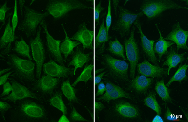 Anti-ACSL3 antibody used in Immunocytochemistry/ Immunofluorescence (ICC/IF). GTX112431