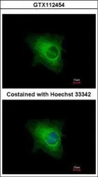 Anti-Cytokeratin 33B antibody used in Immunocytochemistry/ Immunofluorescence (ICC/IF). GTX112454