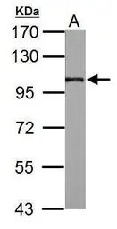 Anti-AP2B1 antibody used in Western Blot (WB). GTX112479
