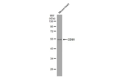 Anti-CDS1 antibody [C1C3] used in Western Blot (WB). GTX112491