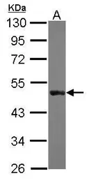 Anti-Cytokeratin 31 antibody [N3C3] used in Western Blot (WB). GTX112529