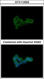 Anti-DLST antibody [N3C3] used in Immunocytochemistry/ Immunofluorescence (ICC/IF). GTX112555