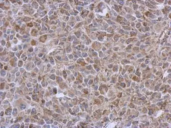 Anti-DLST antibody [N3C3] used in IHC (Paraffin sections) (IHC-P). GTX112555