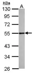 Anti-DLST antibody [N3C3] used in Western Blot (WB). GTX112555