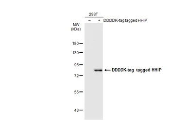 Anti-HHIP antibody [C1C3] used in Western Blot (WB). GTX112565