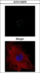 Anti-Coilin antibody used in Immunocytochemistry/ Immunofluorescence (ICC/IF). GTX112570