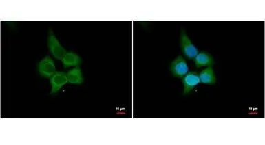 Anti-HHIP antibody [N3C2], Internal used in Immunocytochemistry/ Immunofluorescence (ICC/IF). GTX112584