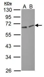 Anti-ERO1L antibody used in Western Blot (WB). GTX112589