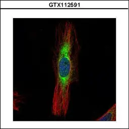 Anti-SCIN antibody [N3C2], Internal used in Immunocytochemistry/ Immunofluorescence (ICC/IF). GTX112591