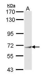 Anti-IFIT3 antibody [N1C1] used in Western Blot (WB). GTX112593
