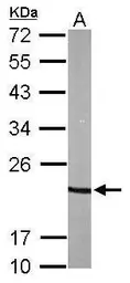 Anti-p23 antibody [N1C3-2] used in Western Blot (WB). GTX112655