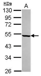 Anti-beta Tubulin antibody used in Western Blot (WB). GTX112658