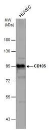 Anti-CD105 antibody [N1N3-2] used in Western Blot (WB). GTX112685