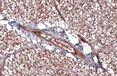 Anti-CD105 antibody [N1N3-2] used in IHC (Paraffin sections) (IHC-P). GTX112685