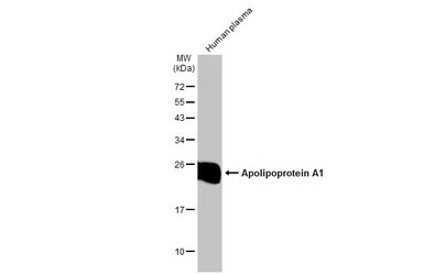 Anti-Apolipoprotein A1 antibody used in Western Blot (WB). GTX112692