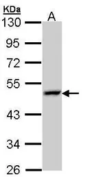 Anti-LAMP3 antibody used in Western Blot (WB). GTX112715