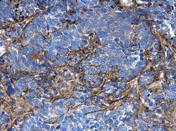 Anti-COL1A1 antibody [N1N2], N-term used in IHC (Paraffin sections) (IHC-P). GTX112731
