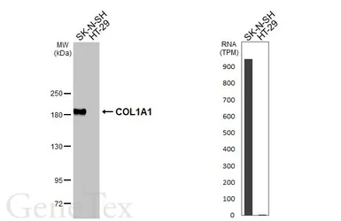 Anti-COL1A1 antibody [N1N2], N-term used in Western Blot (WB). GTX112731