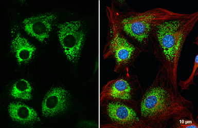 Anti-COL1A1 antibody [N1N2], N-term used in Immunocytochemistry/ Immunofluorescence (ICC/IF). GTX112731
