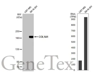 Anti-COL1A1 antibody [N1N2], N-term used in Western Blot (WB). GTX112731