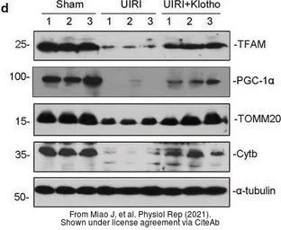 Anti-mtTFA antibody used in Western Blot (WB). GTX112760