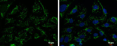 Anti-mtTFA antibody used in Immunocytochemistry/ Immunofluorescence (ICC/IF). GTX112760