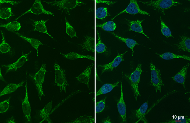 Anti-mtTFA antibody used in Immunocytochemistry/ Immunofluorescence (ICC/IF). GTX112760