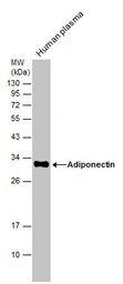 Anti-Adiponectin antibody used in Western Blot (WB). GTX112777