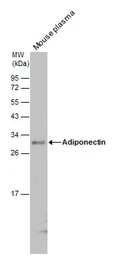 Anti-Adiponectin antibody used in Western Blot (WB). GTX112777