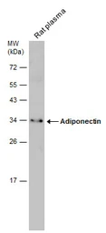 Anti-Adiponectin antibody used in Western Blot (WB). GTX112777