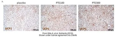 Anti-UCP1 antibody used in IHC (Paraffin sections) (IHC-P). GTX112784