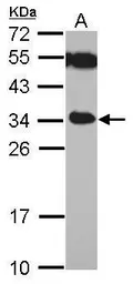 Anti-TICAM2 antibody used in Western Blot (WB). GTX112785