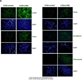 Anti-Fibronectin antibody [N1N2], N-term used in Immunocytochemistry/ Immunofluorescence (ICC/IF). GTX112794