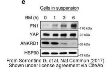 Anti-Fibronectin antibody [N1N2], N-term used in Western Blot (WB). GTX112794