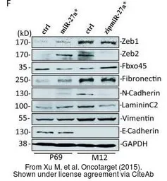 Anti-Fibronectin antibody [N1N2], N-term used in Western Blot (WB). GTX112794