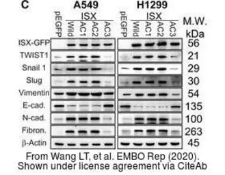 Anti-Fibronectin antibody [N1N2], N-term used in Western Blot (WB). GTX112794