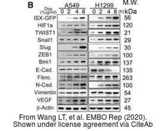 Anti-Fibronectin antibody [N1N2], N-term used in Western Blot (WB). GTX112794