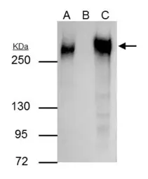 Anti-Fibronectin antibody [N1N2], N-term used in Immunoprecipitation (IP). GTX112794