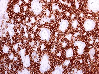 Anti-Cytokeratin 19 antibody [N1C1] used in IHC (Paraffin sections) (IHC-P). GTX112826